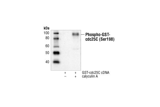 Western Blotting Image 1: Phospho-cdc25C (Ser198) Antibody