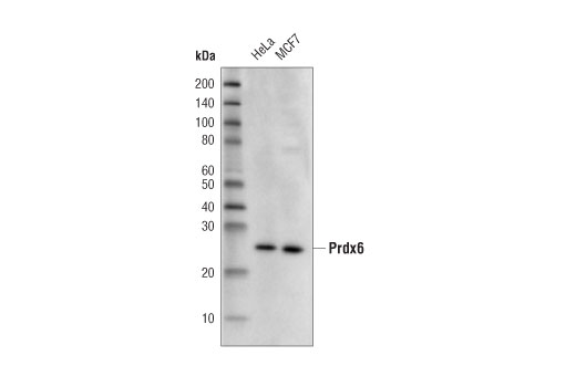 Western Blotting Image 1: Prdx6 Antibody