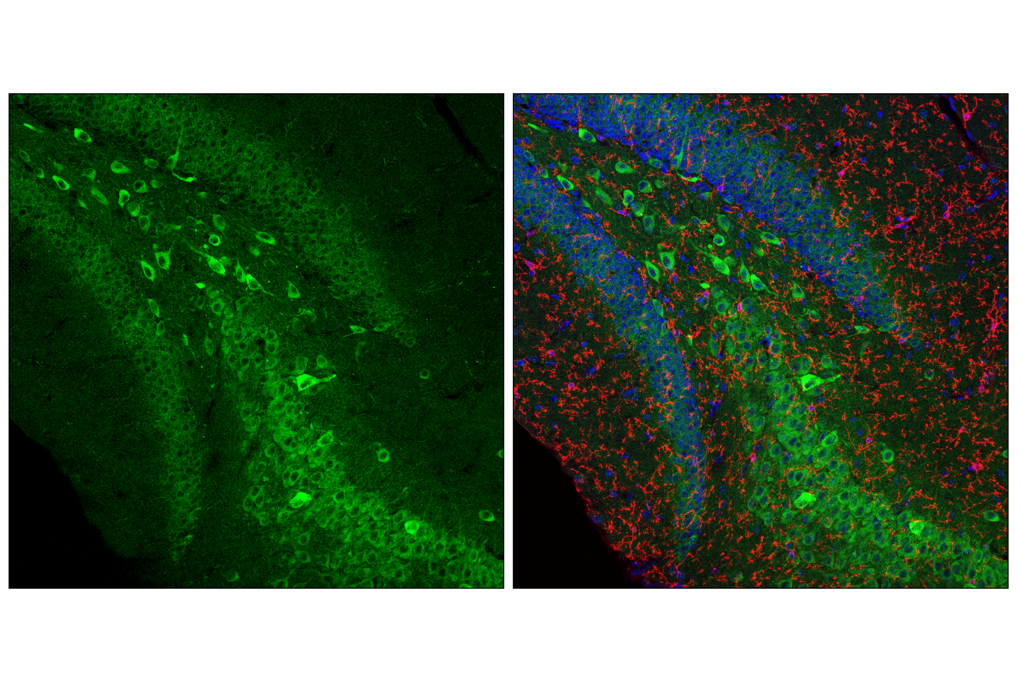 Immunofluorescence Image 1: VAPB (E7R3Z) Rabbit mAb