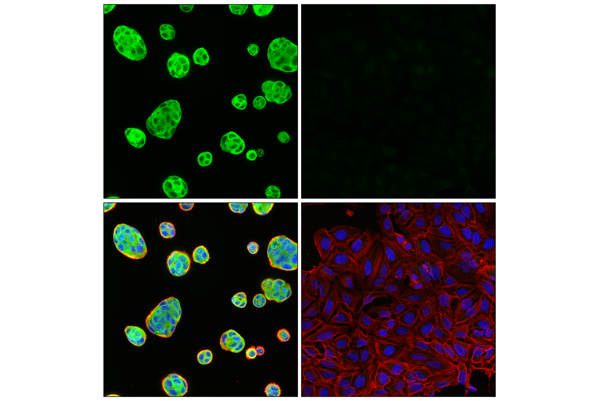 Immunofluorescence Image 3: VAPB (E7R3Z) Rabbit mAb