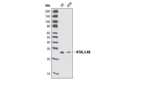 Western Blotting Image 1: NTAL/LAB Antibody