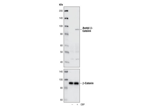 Western Blotting Image 1: Acetyl-β-Catenin (Lys49) Antibody