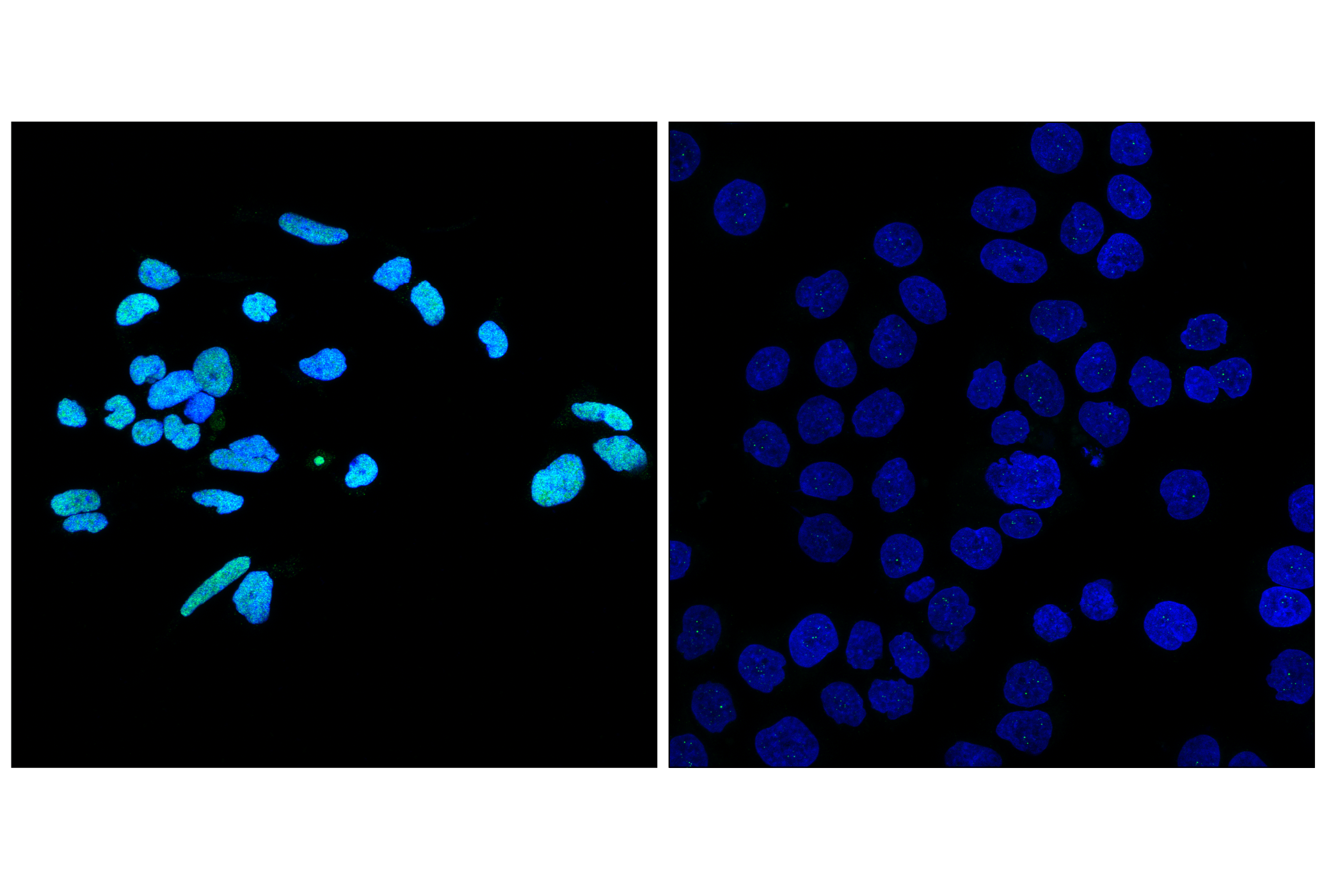 Immunofluorescence Image 1: TCF12/HEB (E8R5E) Rabbit mAb