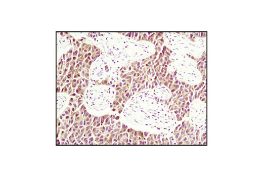Immunohistochemistry Image 1: PDCD4 (D29C6) XP® Rabbit mAb
