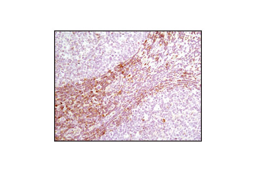 Immunohistochemistry Image 2: PDCD4 (D29C6) XP® Rabbit mAb