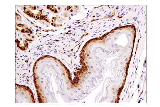 Immunohistochemistry Image 3: PDCD4 (D29C6) XP® Rabbit mAb