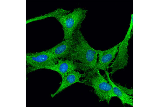 Immunofluorescence Image 1: Ribosomal Protein S3 (D50G7) XP® Rabbit mAb