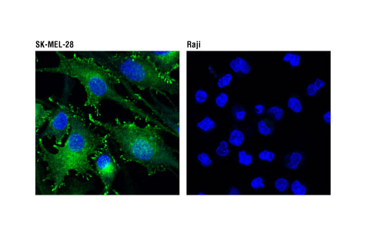 Immunofluorescence Image 1: Rab27A (D7V6B) Rabbit mAb
