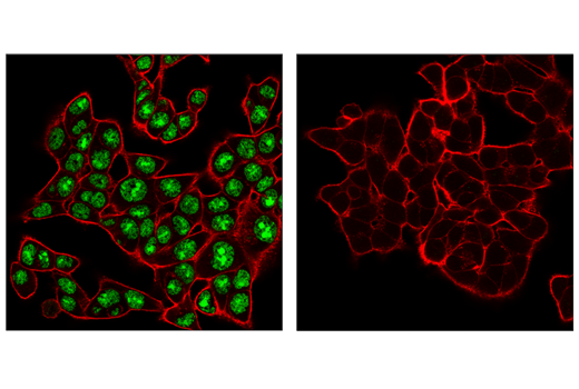 Immunofluorescence Image 1: ADAR1 (E6X9R) XP® Rabbit mAb (BSA and Azide Free)