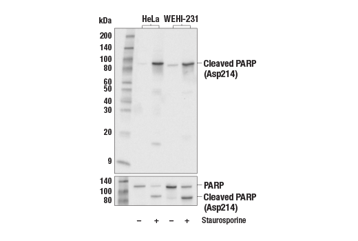 Western Blotting Image 1: Cleaved PARP (Asp214) Antibody