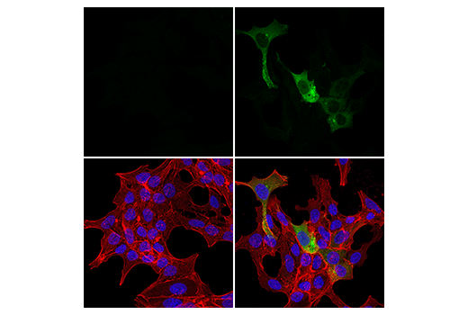 Immunofluorescence Image 1: iNOS (E2M9F) Rabbit mAb