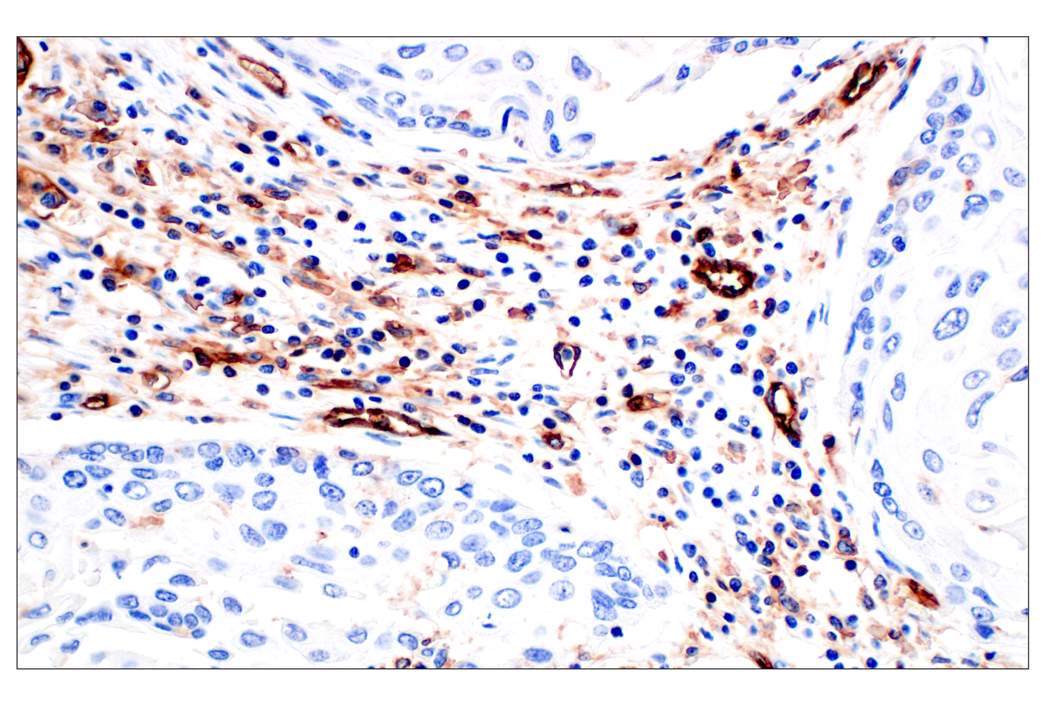 Immunohistochemistry Image 6: CD31 (PECAM-1) (F8M3S) Rabbit mAb