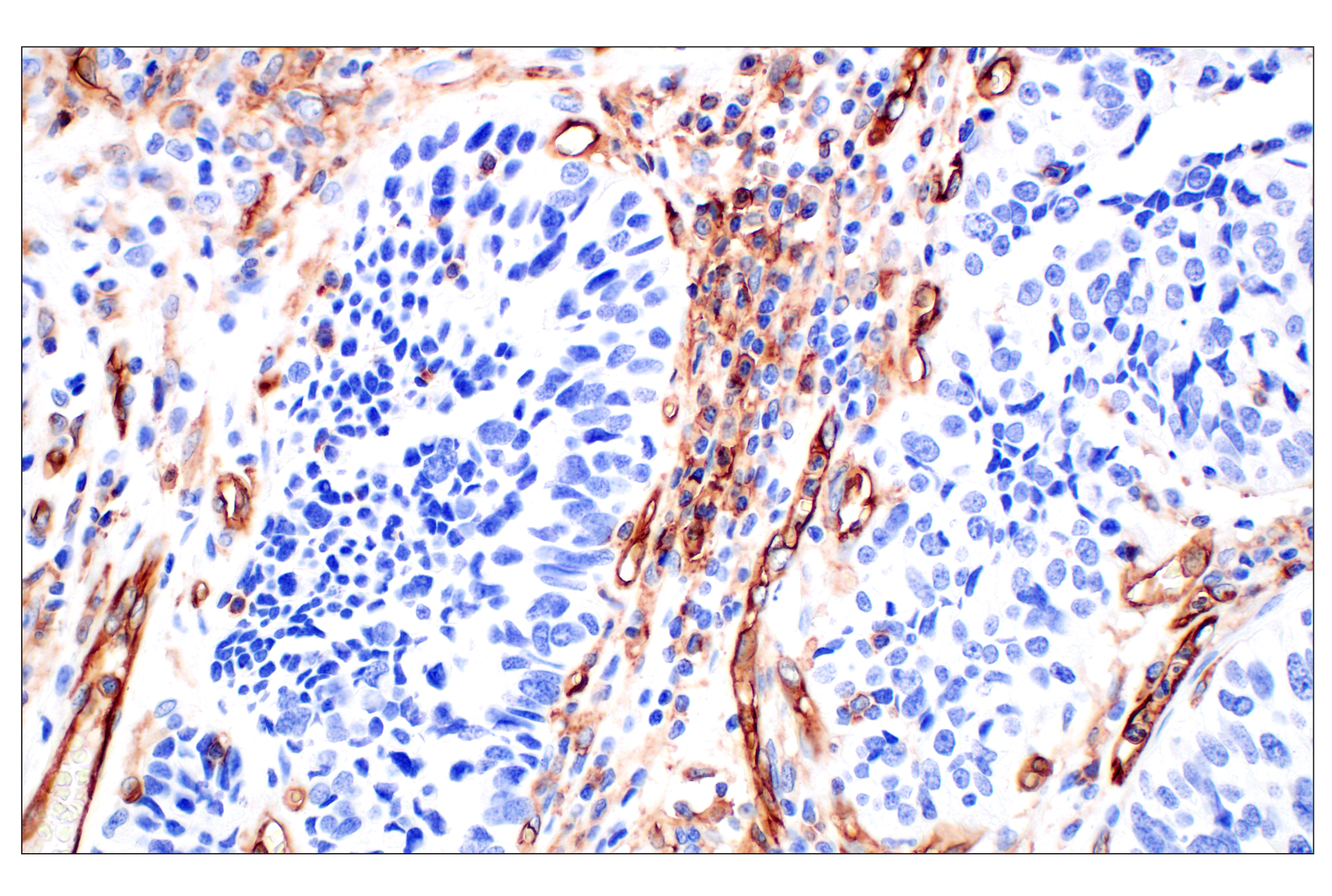 Immunohistochemistry Image 5: CD31 (PECAM-1) (F8M3S) Rabbit mAb