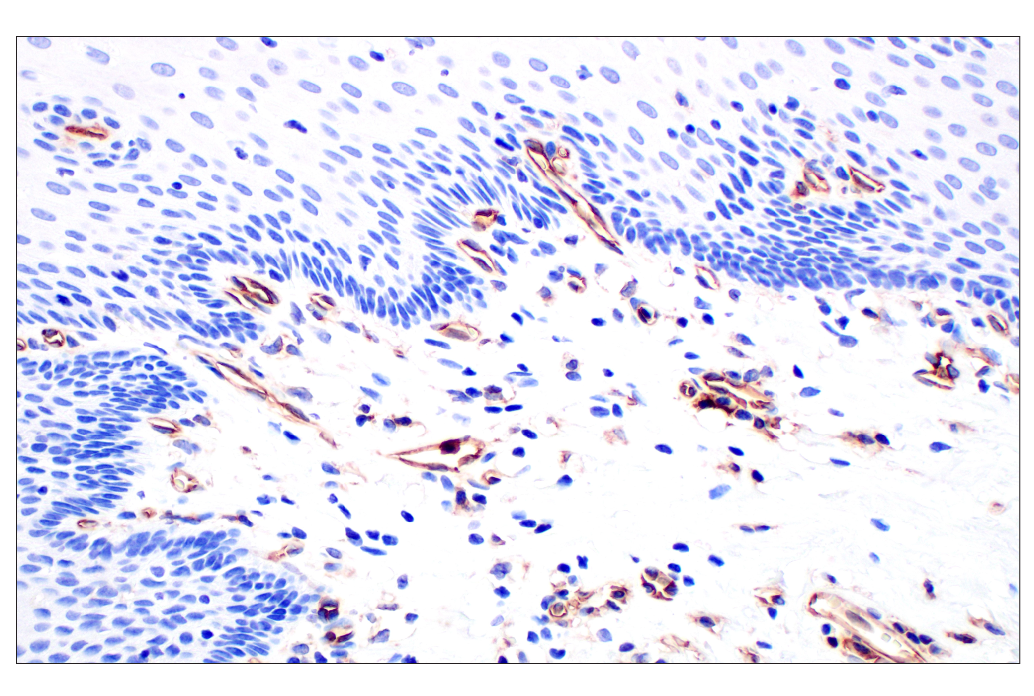Immunohistochemistry Image 10: CD31 (PECAM-1) (F8M3S) Rabbit mAb