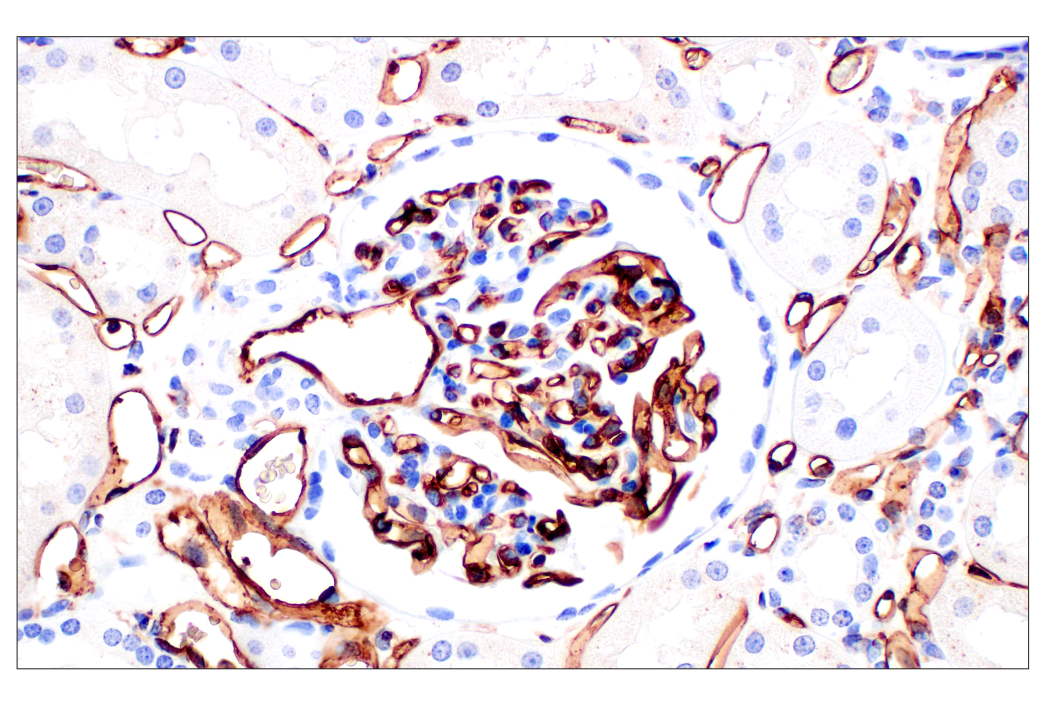 Immunohistochemistry Image 4: CD31 (PECAM-1) (F8M3S) Rabbit mAb