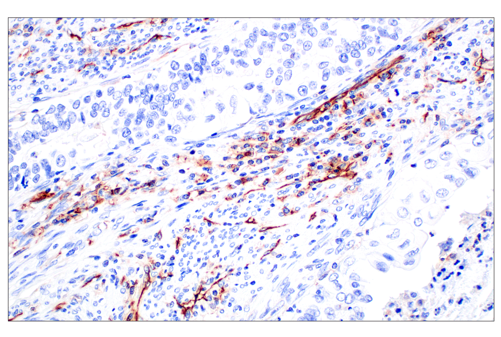 Immunohistochemistry Image 9: CD31 (PECAM-1) (F8M3S) Rabbit mAb