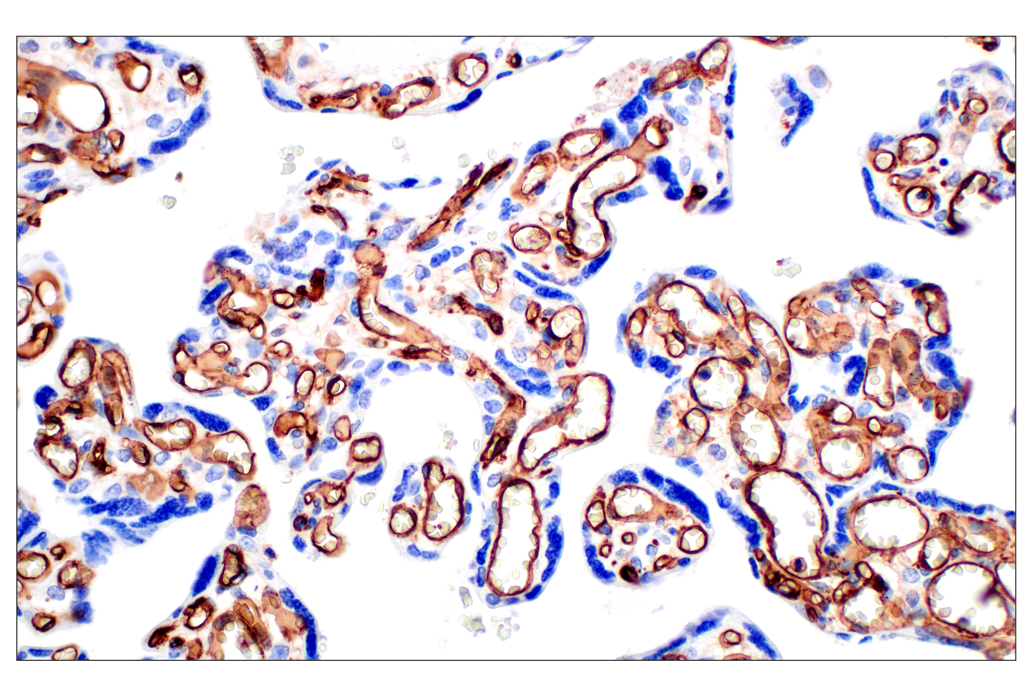 Immunohistochemistry Image 12: CD31 (PECAM-1) (F8M3S) Rabbit mAb
