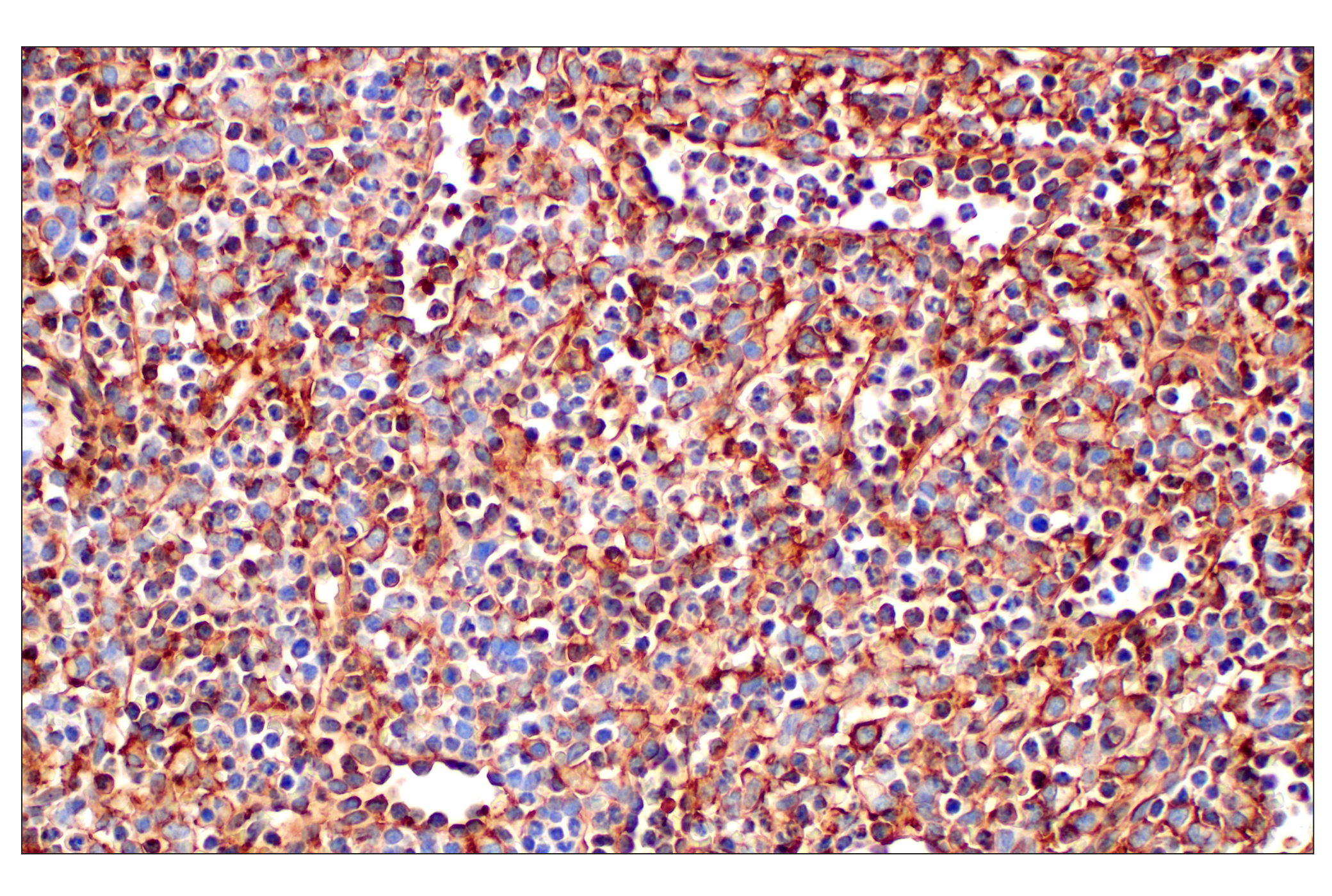 Immunohistochemistry Image 3: CD31 (PECAM-1) (F8M3S) Rabbit mAb