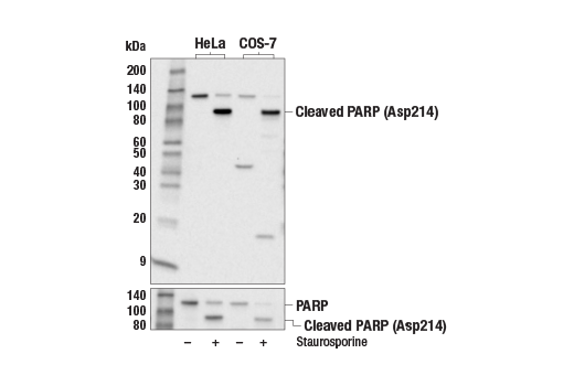 Western Blotting Image 1: Cleaved PARP (Asp214) (19F4) Mouse mAb