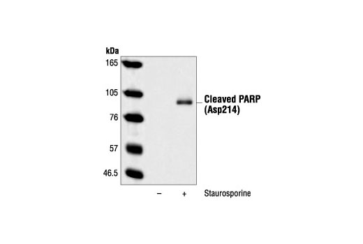  Image 11: Apoptosis Antibody Sampler Kit (Mouse Preferred)