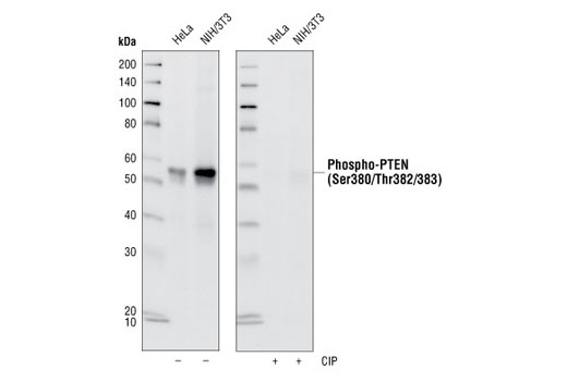  Image 5: PTEN and PDK1 Antibody Sampler Kit II