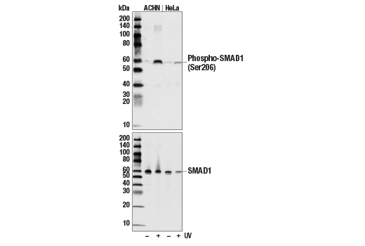 Western Blotting Image 1: Phospho-SMAD1 (Ser206) Antibody