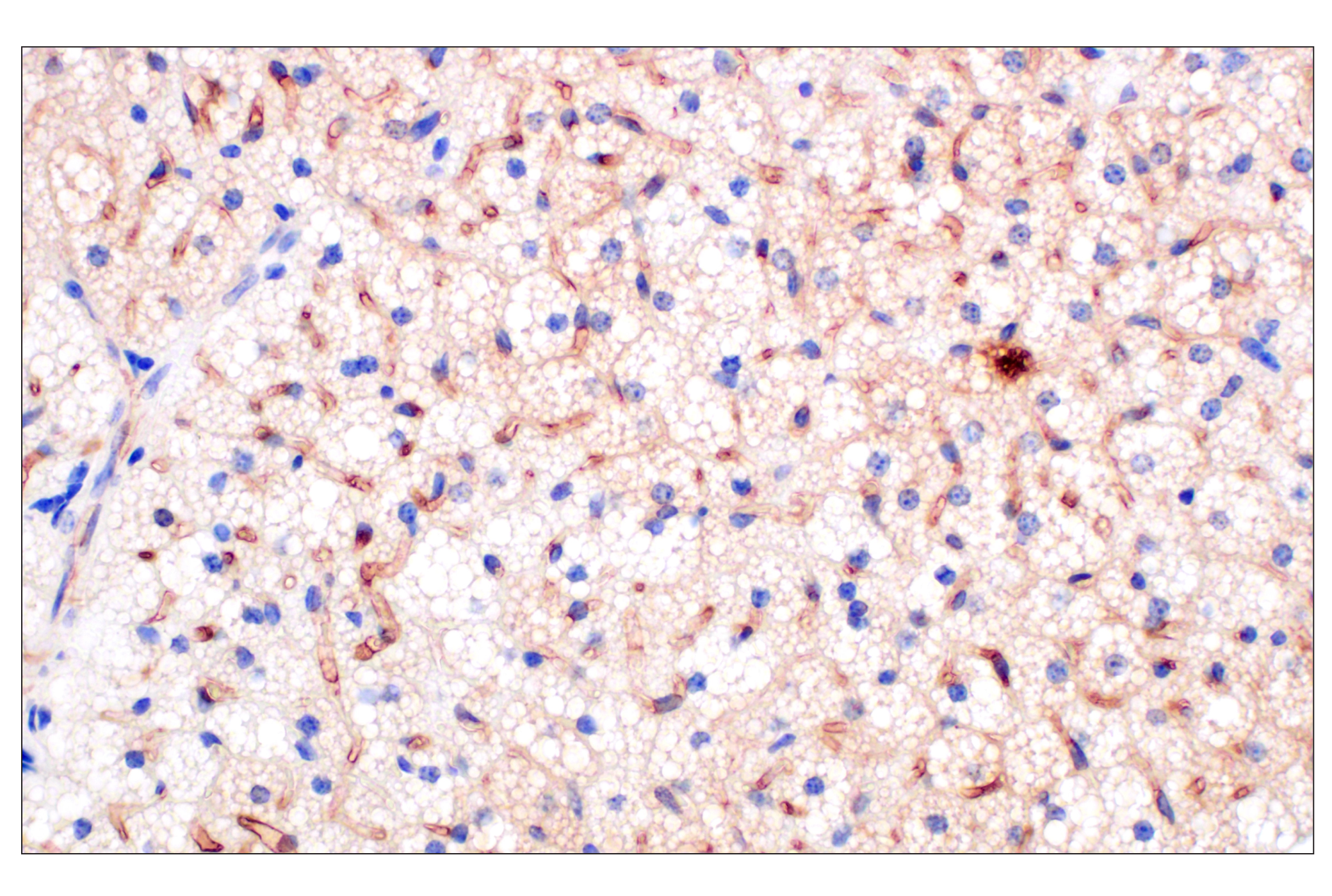 Immunohistochemistry Image 2: PNPLA3 (E7N6O) Rabbit mAb