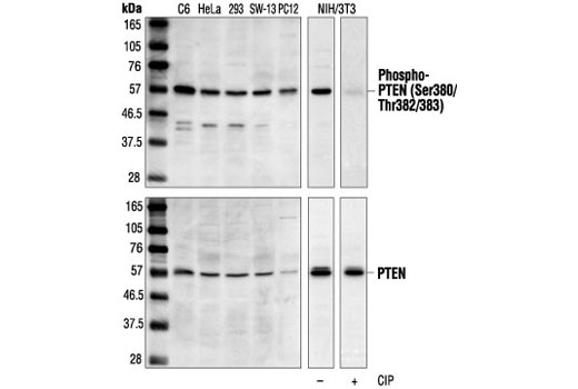 Western Blotting Image 1: Phospho-PTEN (Ser380/Thr382/383) Antibody