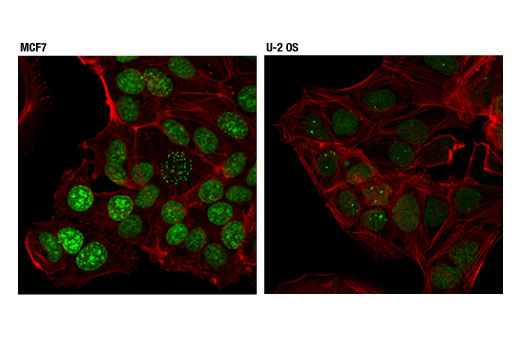 Immunofluorescence Image 1: RIF1 (D2F2M) Rabbit mAb