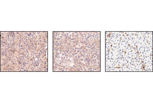  Image 56: Oncogene and Tumor Suppressor Antibody Sampler Kit