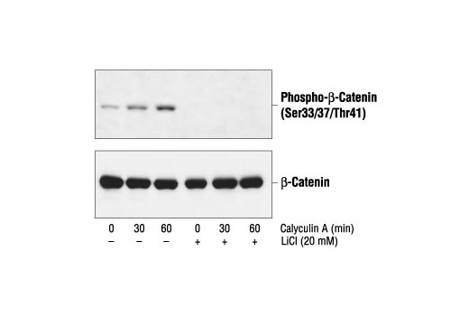 Western Blotting Image 1: Phospho-β-Catenin (Ser33/37/Thr41) Antibody