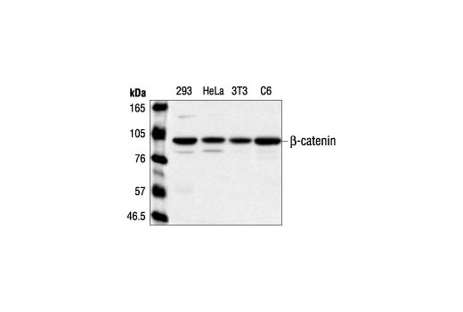 Western Blotting Image 1: β-Catenin Antibody