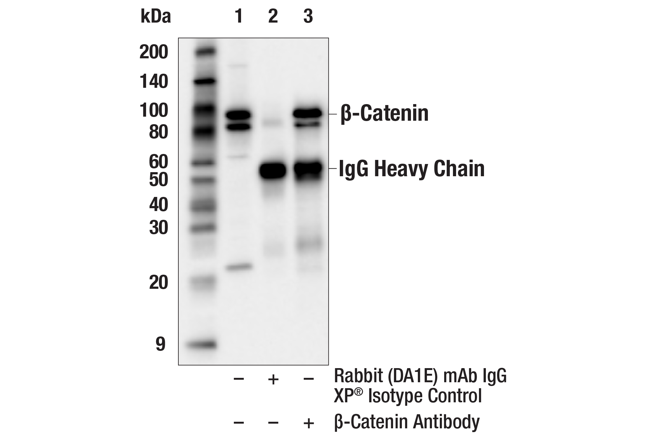 Immunoprecipitation Image 1: β-Catenin Antibody