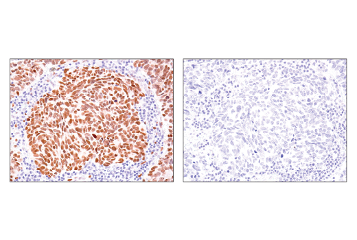 Immunohistochemistry Image 4: TEAD1 (D9X2L) Rabbit mAb (BSA and Azide Free)
