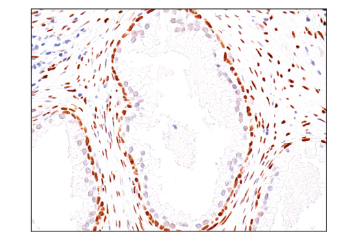 Immunohistochemistry Image 6: TEAD1 (D9X2L) Rabbit mAb (BSA and Azide Free)