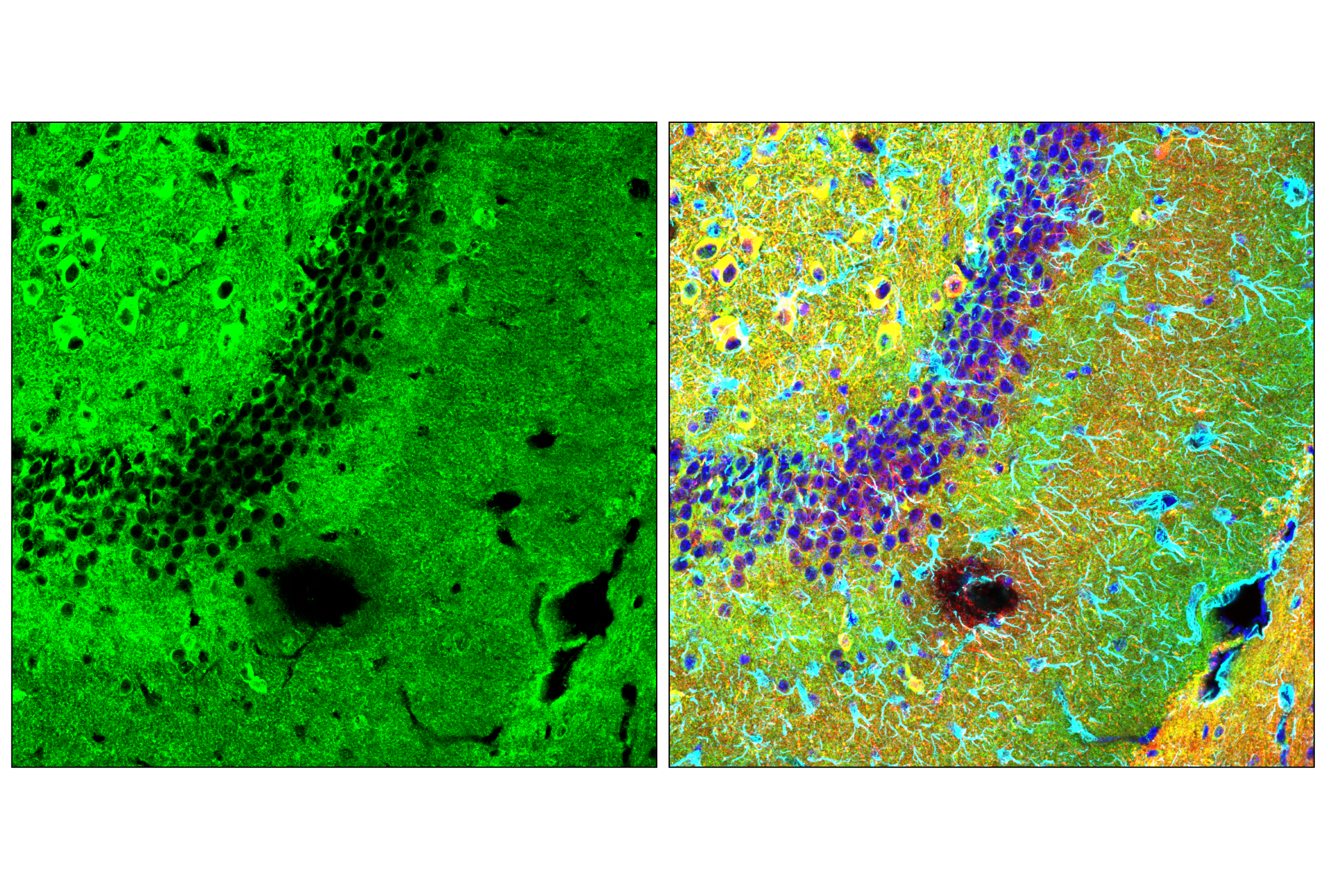 Immunofluorescence Image 2: Phospho-Tau (Thr205) (E9A7P) Mouse mAb (BSA and Azide Free)