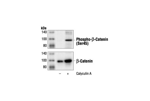 Western Blotting Image 1: Phospho-β-Catenin (Ser45) Antibody