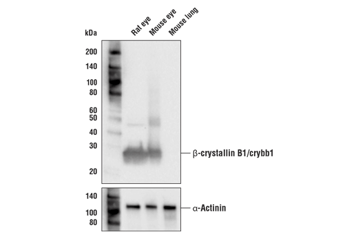 Western Blotting Image 1: β-crystallin B1/crybb1 Rabbit Antibody