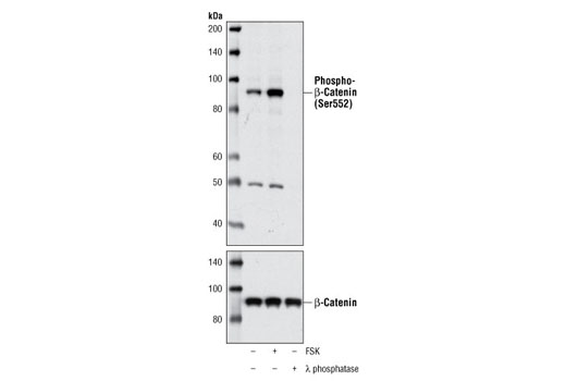 Western Blotting Image 1: Phospho-β-Catenin (Ser552) Antibody