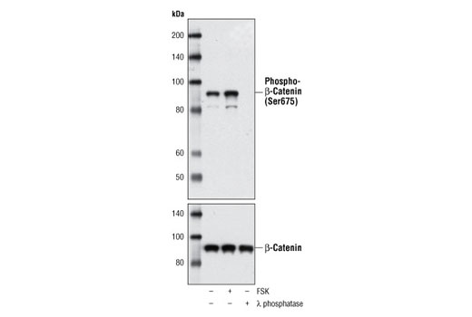 Western Blotting Image 1: Phospho-β-Catenin (Ser675) Antibody
