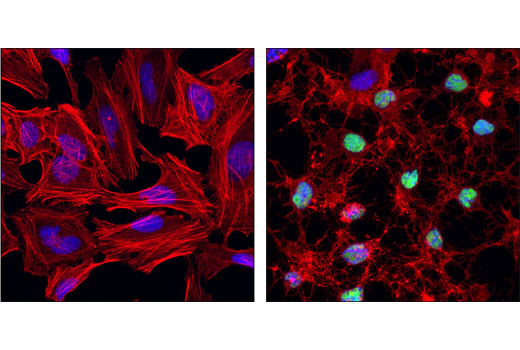 Immunofluorescence Image 1: Cleaved PARP (Asp214) (D64E10) XP® Rabbit mAb (BSA and Azide Free)