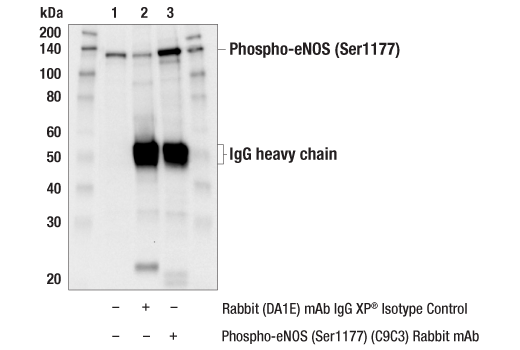 Immunoprecipitation Image 1: Phospho-eNOS (Ser1177) (C9C3) Rabbit mAb