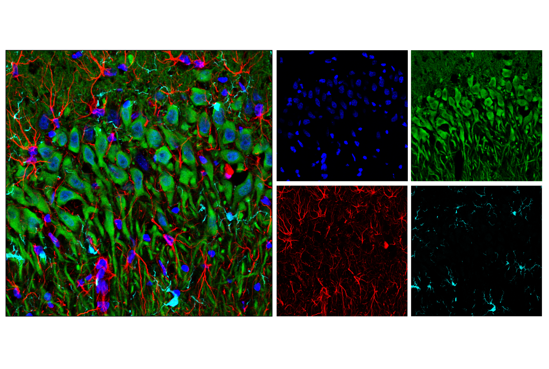 Immunofluorescence Image 2: GFAP (E8S7G) Mouse mAb
