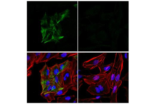 Immunofluorescence Image 3: GFAP (E8S7G) Mouse mAb