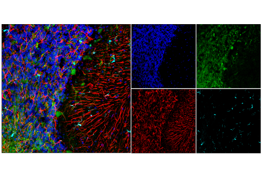 Immunofluorescence Image 1: GFAP (E8S7G) Mouse mAb
