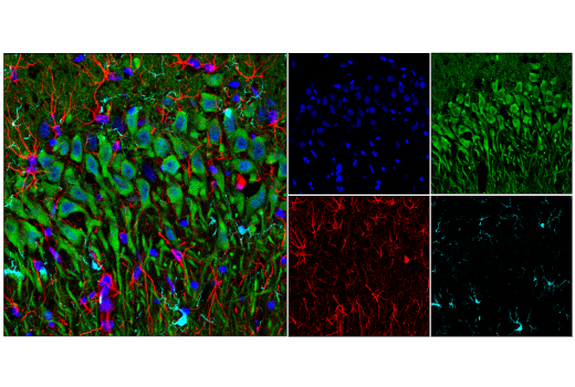 Immunofluorescence Image 2: GFAP (E8S7G) Mouse mAb