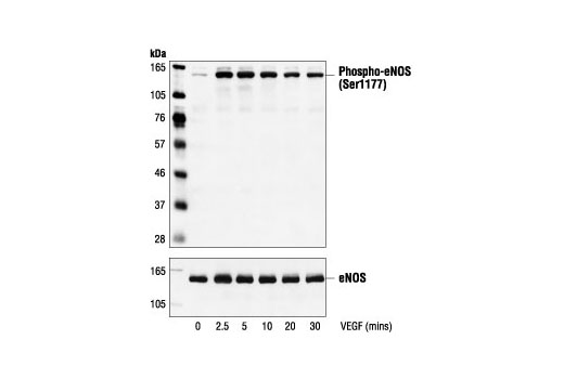 Western Blotting Image 1: Phospho-eNOS (Ser1177) Antibody