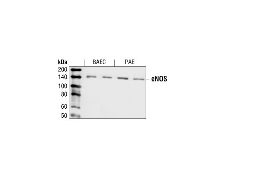 Western Blotting Image 1: eNOS Antibody