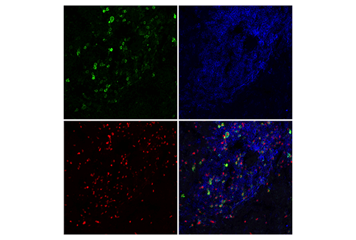 Immunofluorescence Image 1: IL-2Rα/CD25 (E9W2J) XP® Rabbit mAb (BSA and Azide Free)