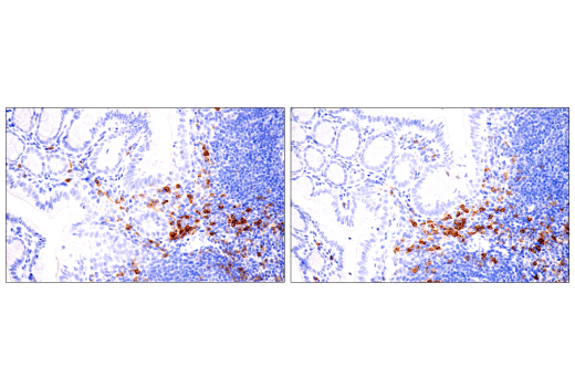 Immunohistochemistry Image 3: IL-2Rα/CD25 (E9W2J) XP® Rabbit mAb (BSA and Azide Free)